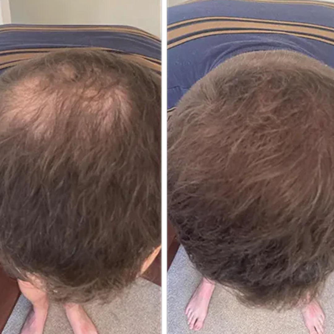 Pack de Esenciales para un cabello más grueso y voluminoso